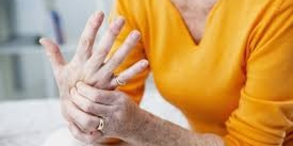 Customized Osteoarthritis Care: Expert Physiotherapy in Surrey